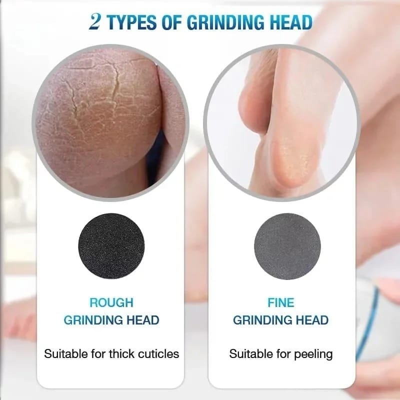 back callus remover with built in vacuum ? electric foot grinder for dead skin, cracked heels & calluses, rechargeable pedicure tool with gentle & powerful exfoliation back callus remover with built in vacuum ? electric foot grinder for dead skin, cracked heels & calluses, rechargeable pedicure tool with gentle & powerful exfoliation